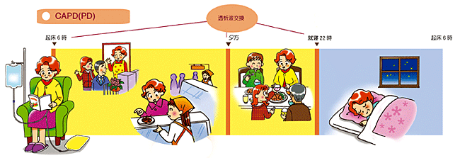 腹膜透析の仕組みと種類 腹膜透析 治療法について 腎臓病について 一般社団法人 全国腎臓病協議会 全腎協